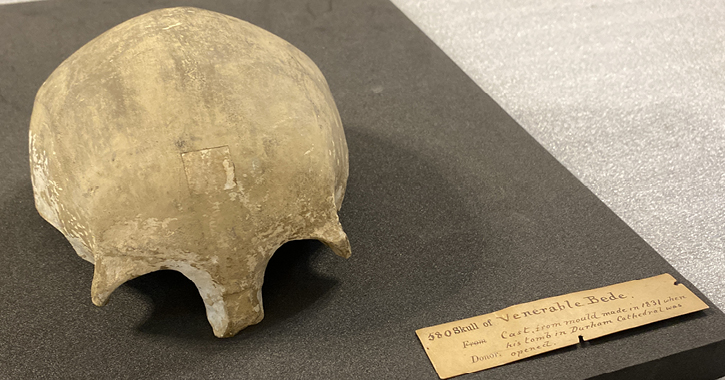 cast of Bede's skull on display at Durham Cathedral Museum